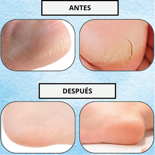 Calcetines Hidratantes de Silicona - Pack de 2 pares