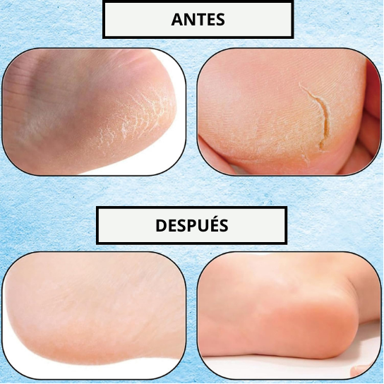 Calcetines Hidratantes de Silicona - Pack de 2 pares