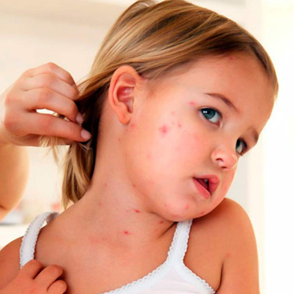 Biodefense: Crema Natural Repelente con Vitamina B - Pack 2 unidades